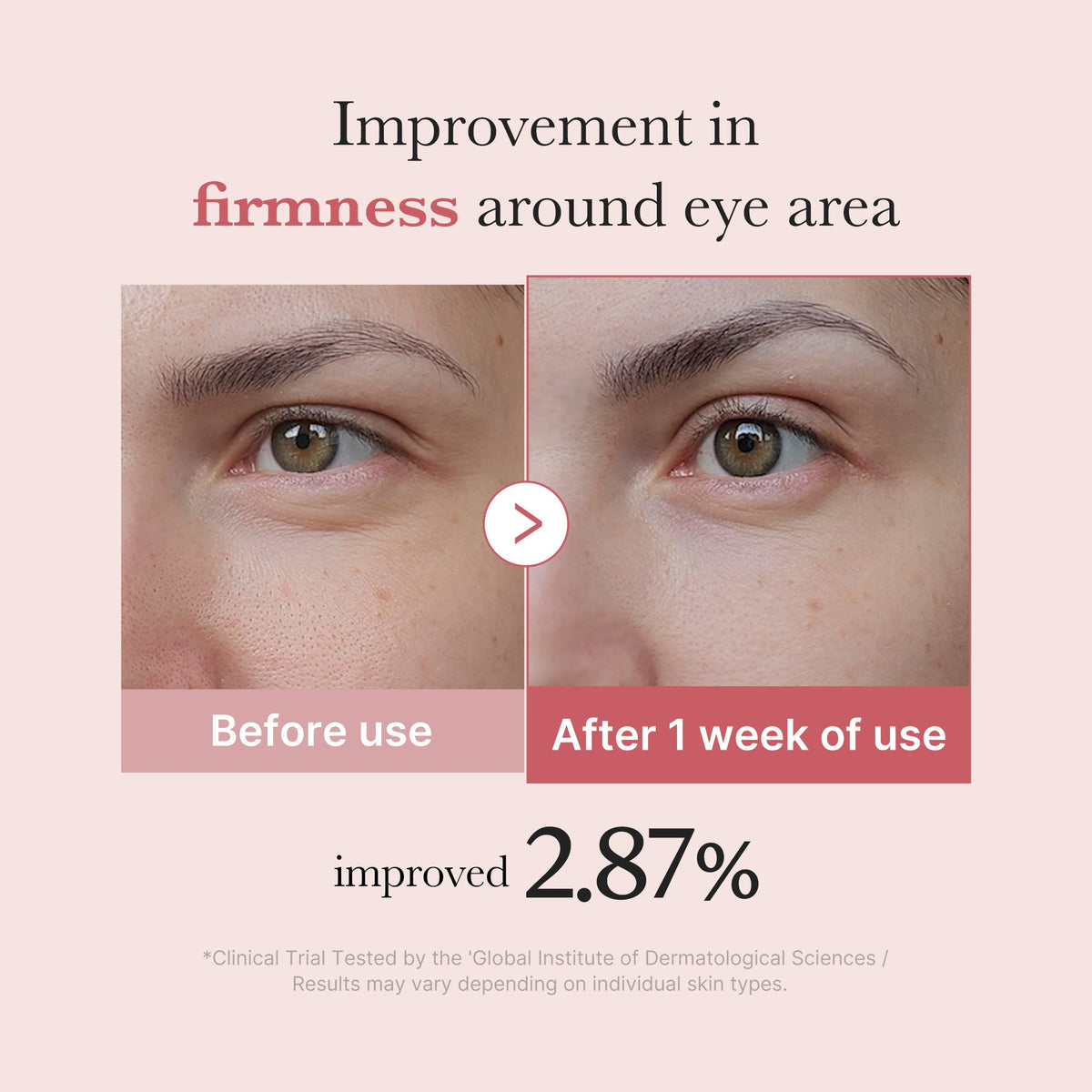 [Subscr.] PDRN Pink Peptide Eye Cream